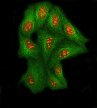 SSRP1 Rabbit Polyclonal Antibody