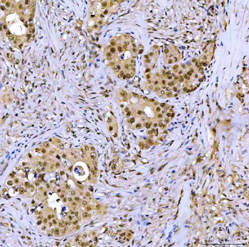 SSRP1 Rabbit Polyclonal Antibody