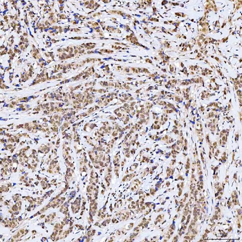 SSRP1 Rabbit Polyclonal Antibody