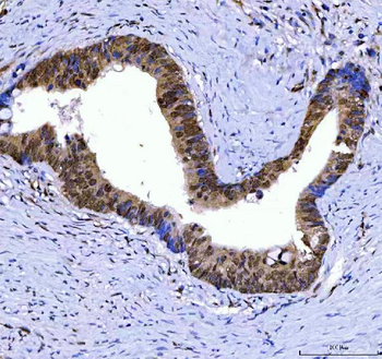 SSRP1 Rabbit Polyclonal Antibody