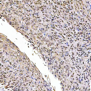 SSRP1 Rabbit Polyclonal Antibody