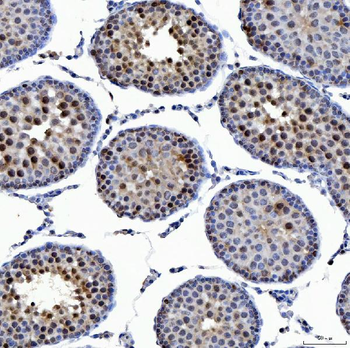 SSRP1 Rabbit Polyclonal Antibody