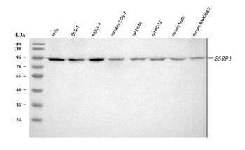 SSRP1 Rabbit Polyclonal Antibody