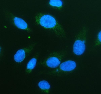 Serine racemase/SRR Rabbit Polyclonal Antibody
