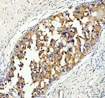 Serine racemase/SRR Rabbit Polyclonal Antibody