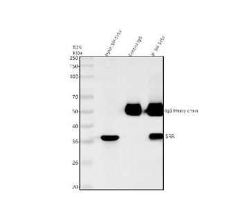 Serine racemase/SRR Rabbit Polyclonal Antibody