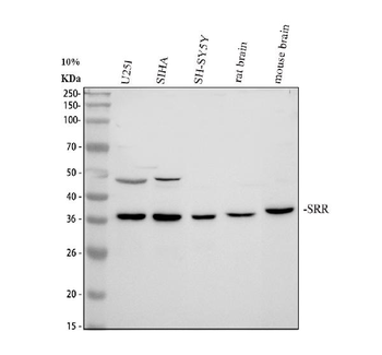 Serine racemase/SRR Rabbit Polyclonal Antibody