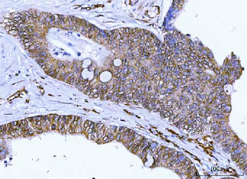 Nesprin 2/SYNE2 Rabbit Polyclonal Antibody