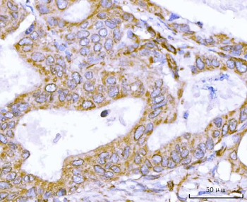 Nesprin 2/SYNE2 Rabbit Polyclonal Antibody