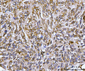 Nesprin 2/SYNE2 Rabbit Polyclonal Antibody