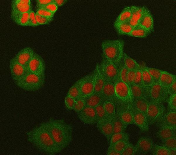 Symplekin/SYMPK Antibody