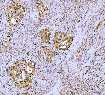 Symplekin/SYMPK Antibody