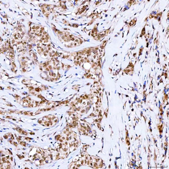 Symplekin/SYMPK Antibody