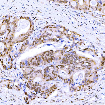 Symplekin/SYMPK Antibody