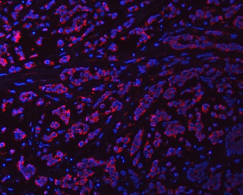 Syntaxin 18/STX18 Rabbit Polyclonal Antibody