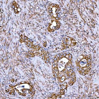Syntaxin 18/STX18 Rabbit Polyclonal Antibody