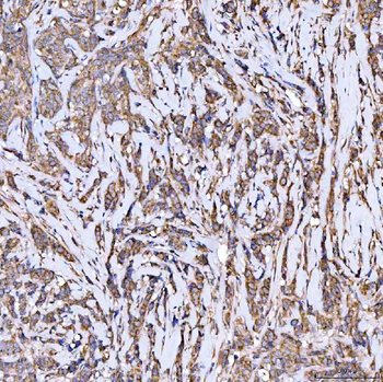 Syntaxin 18/STX18 Rabbit Polyclonal Antibody