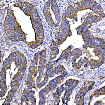 Syntaxin 18/STX18 Rabbit Polyclonal Antibody