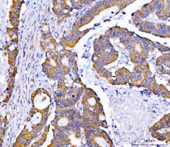 Syntaxin 18/STX18 Rabbit Polyclonal Antibody