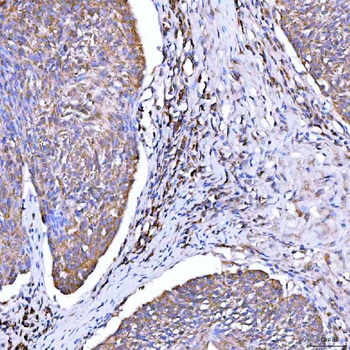 Syntaxin 18/STX18 Rabbit Polyclonal Antibody