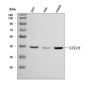 Syntaxin 18/STX18 Rabbit Polyclonal Antibody