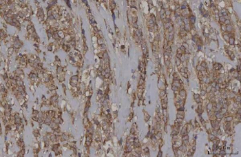 STON1 Antibody