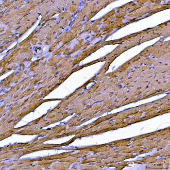 Sarcalumenin/Srl Rabbit Polyclonal Antibody