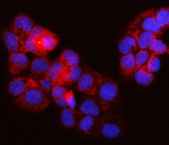 SURF1 Rabbit Polyclonal Antibody