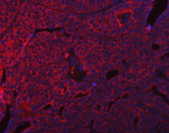 SUMF2 Rabbit Polyclonal Antibody