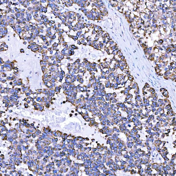 SUMF2 Rabbit Polyclonal Antibody