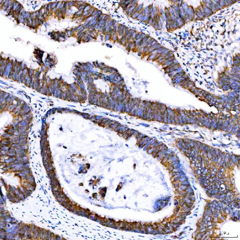 SUMF2 Rabbit Polyclonal Antibody