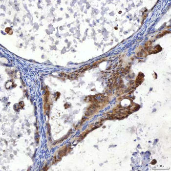 SUMF2 Rabbit Polyclonal Antibody