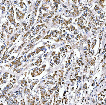 SUCLG2 Antibody