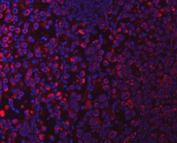 SUCLG1 Rabbit Polyclonal Antibody