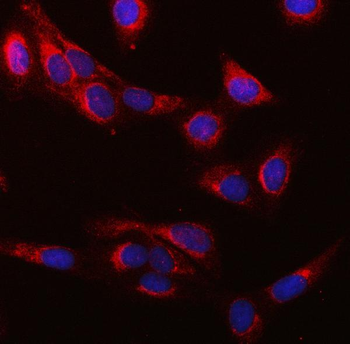 SUCLG1 Rabbit Polyclonal Antibody
