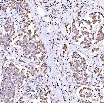 SUCLG1 Rabbit Polyclonal Antibody