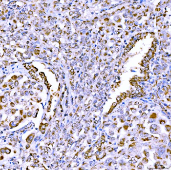 SUCLG1 Rabbit Polyclonal Antibody