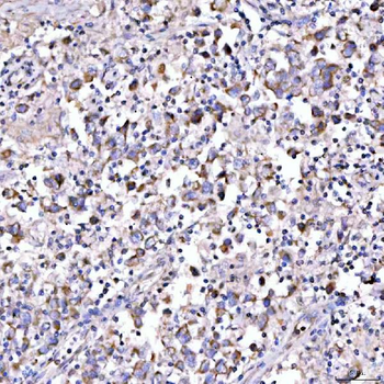 SUCLG1 Rabbit Polyclonal Antibody