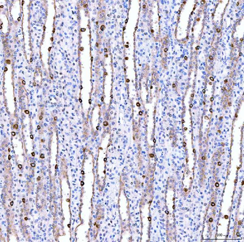 SUCLG1 Rabbit Polyclonal Antibody