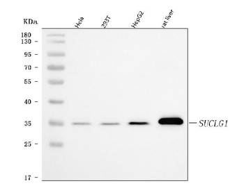 SUCLG1 Rabbit Polyclonal Antibody