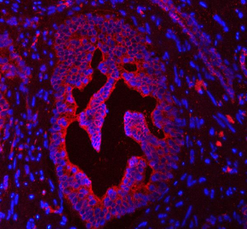 Cytokeratin 4/KRT4 Rabbit Polyclonal Antibody
