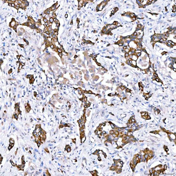 Cytokeratin 4/KRT4 Rabbit Polyclonal Antibody
