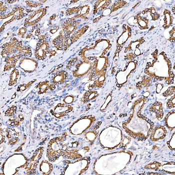 Cytokeratin 4/KRT4 Rabbit Polyclonal Antibody