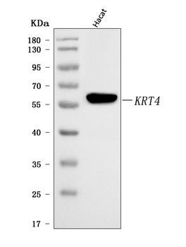Cytokeratin 4/KRT4 Rabbit Polyclonal Antibody