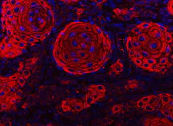 Cytokeratin 2e/KRT2 Antibody