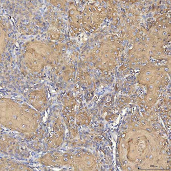 Cytokeratin 2e/KRT2 Antibody