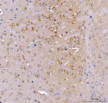 SRGAP3 Rabbit Polyclonal Antibody