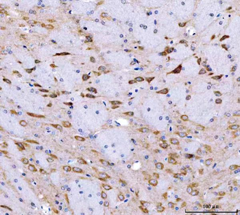 SRGAP3 Rabbit Polyclonal Antibody