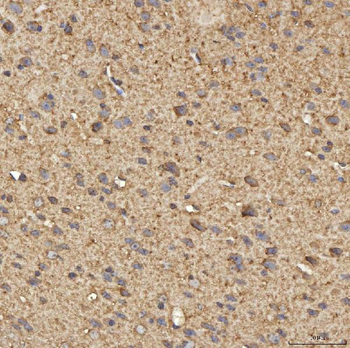 SPTBN2 Rabbit Polyclonal Antibody