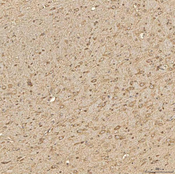 SPTBN2 Rabbit Polyclonal Antibody